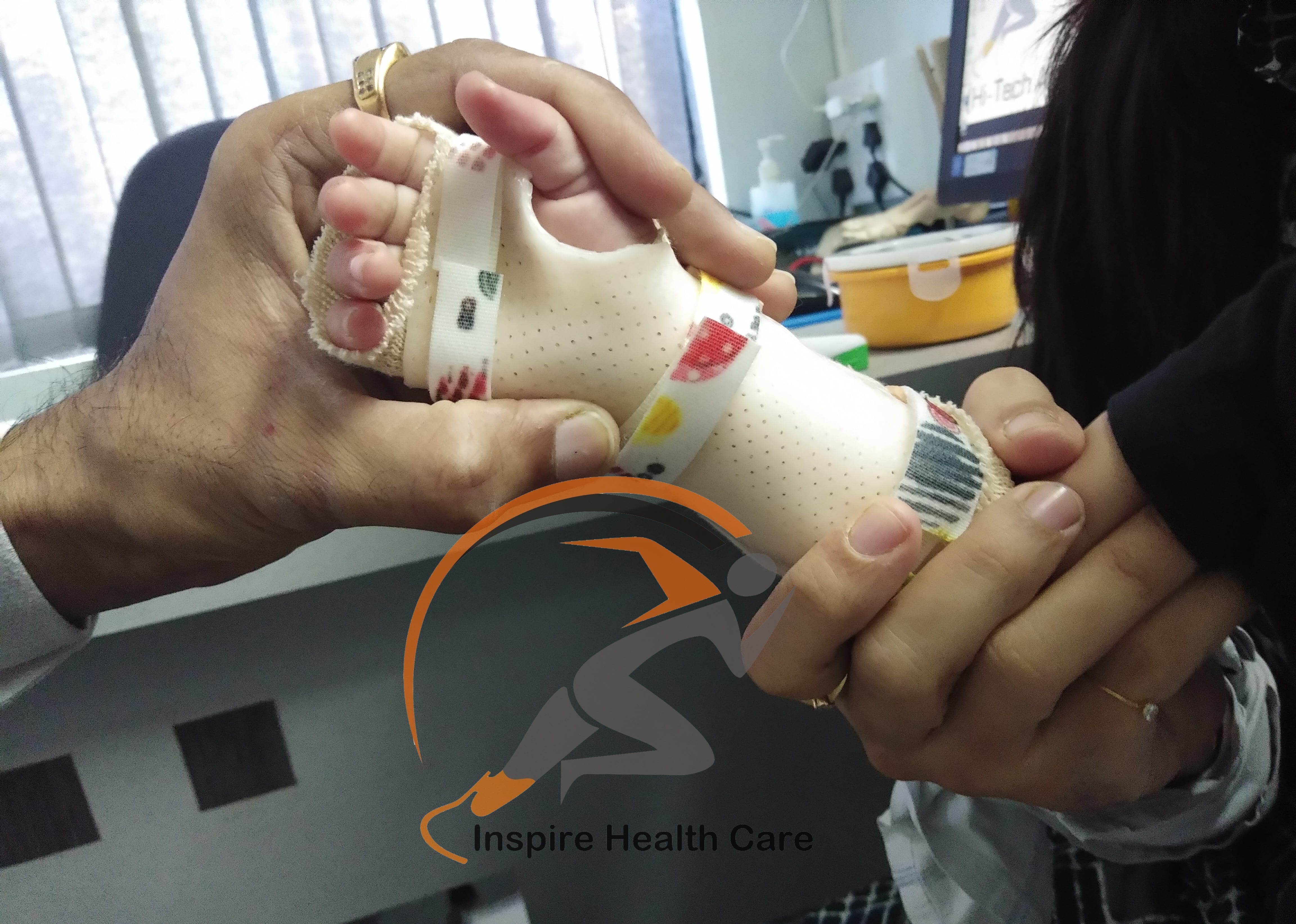 Inspire Structure | Low Temperature Thermo Plastic Splinting